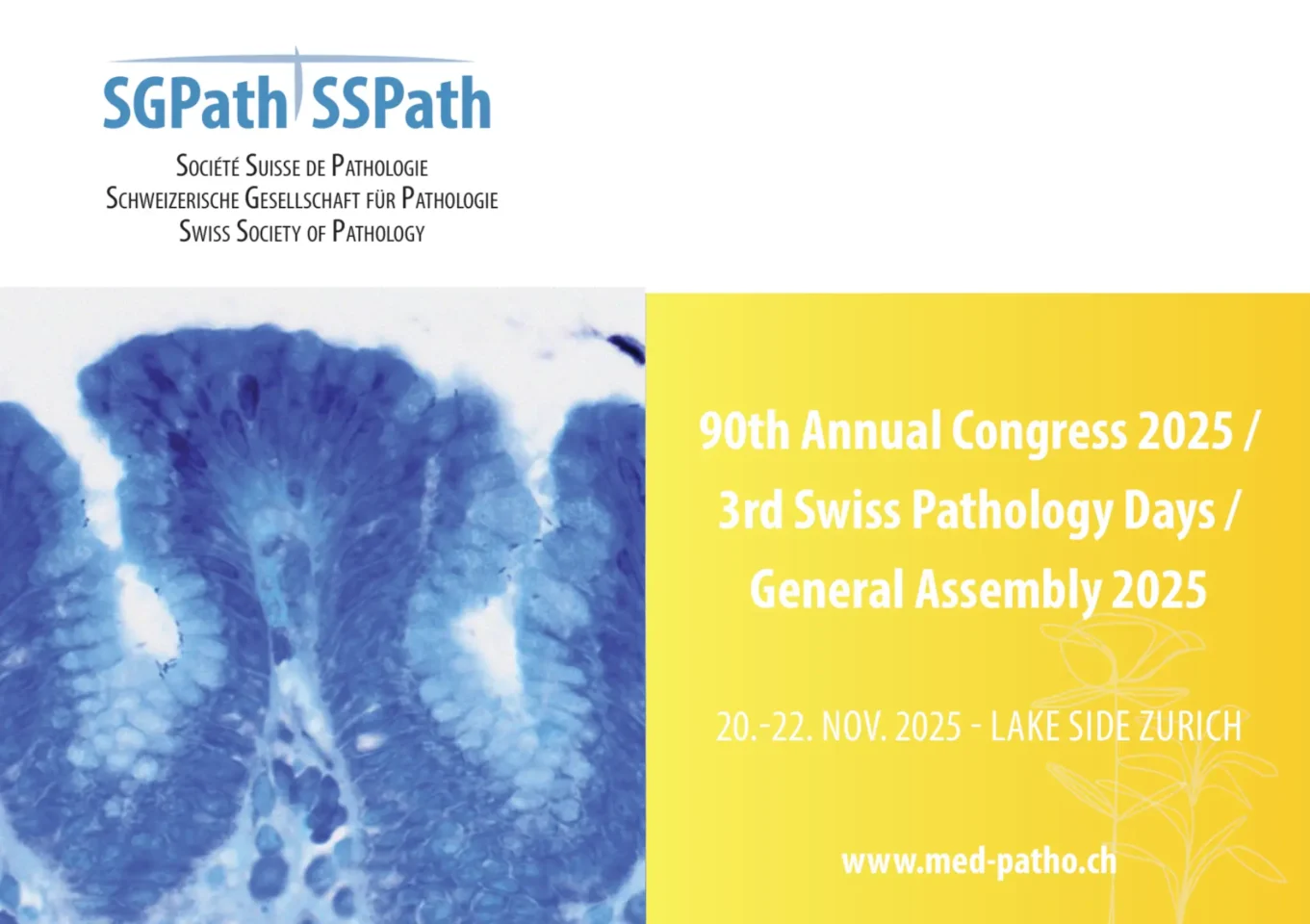 IHU RespirERA presents in Zurich its latest advances in liquid biopsy for lung cancer during the 90th Annual Meeting of the Swiss Society of Pathology.