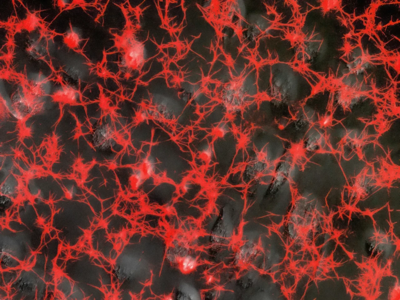 The lung microbiome opens new perspectives to better understand and treat pulmonary fibrosis.