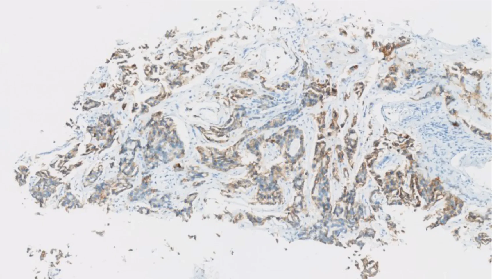 A review published in Lung Cancer highlights the role of biomarkers in guiding the use of new targeted treatments for lung cancer.