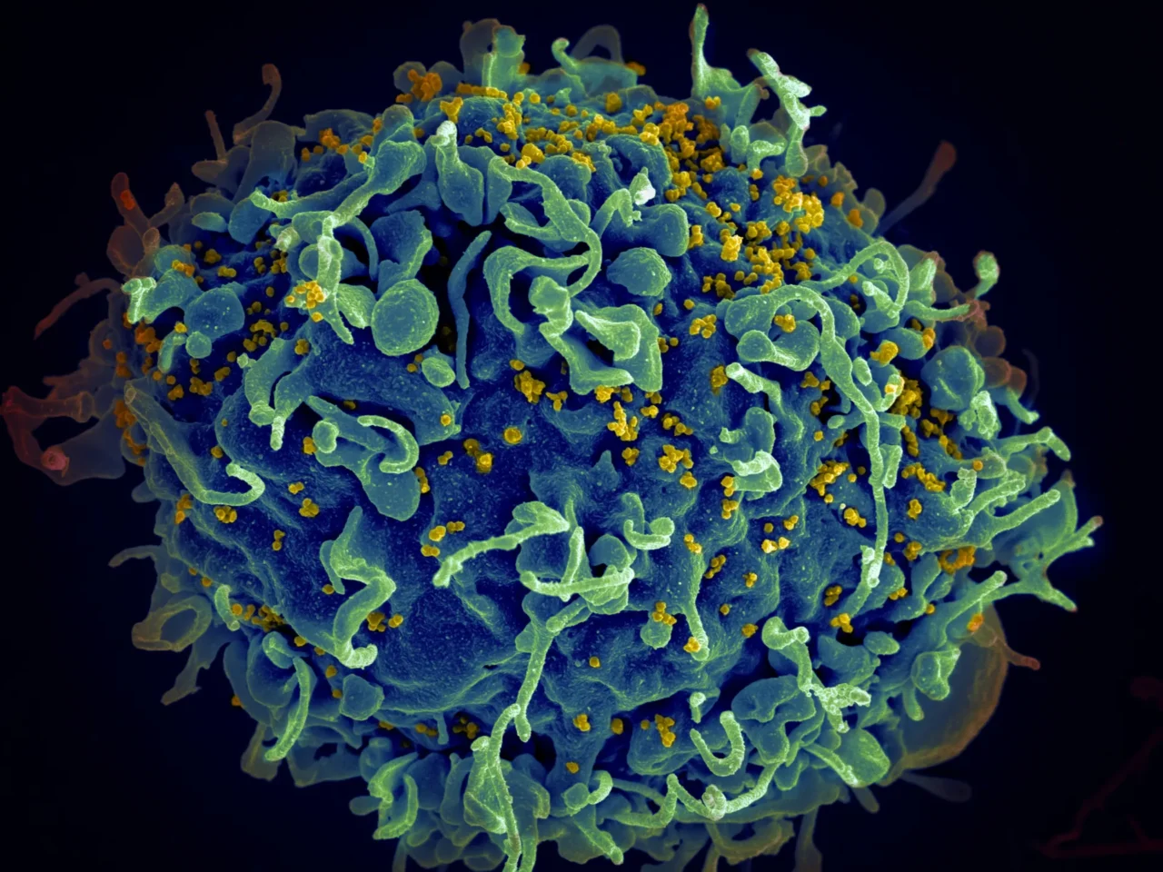 A study involving the RespirERA Institute helps improve the selection of targets for cancer immunotherapy.