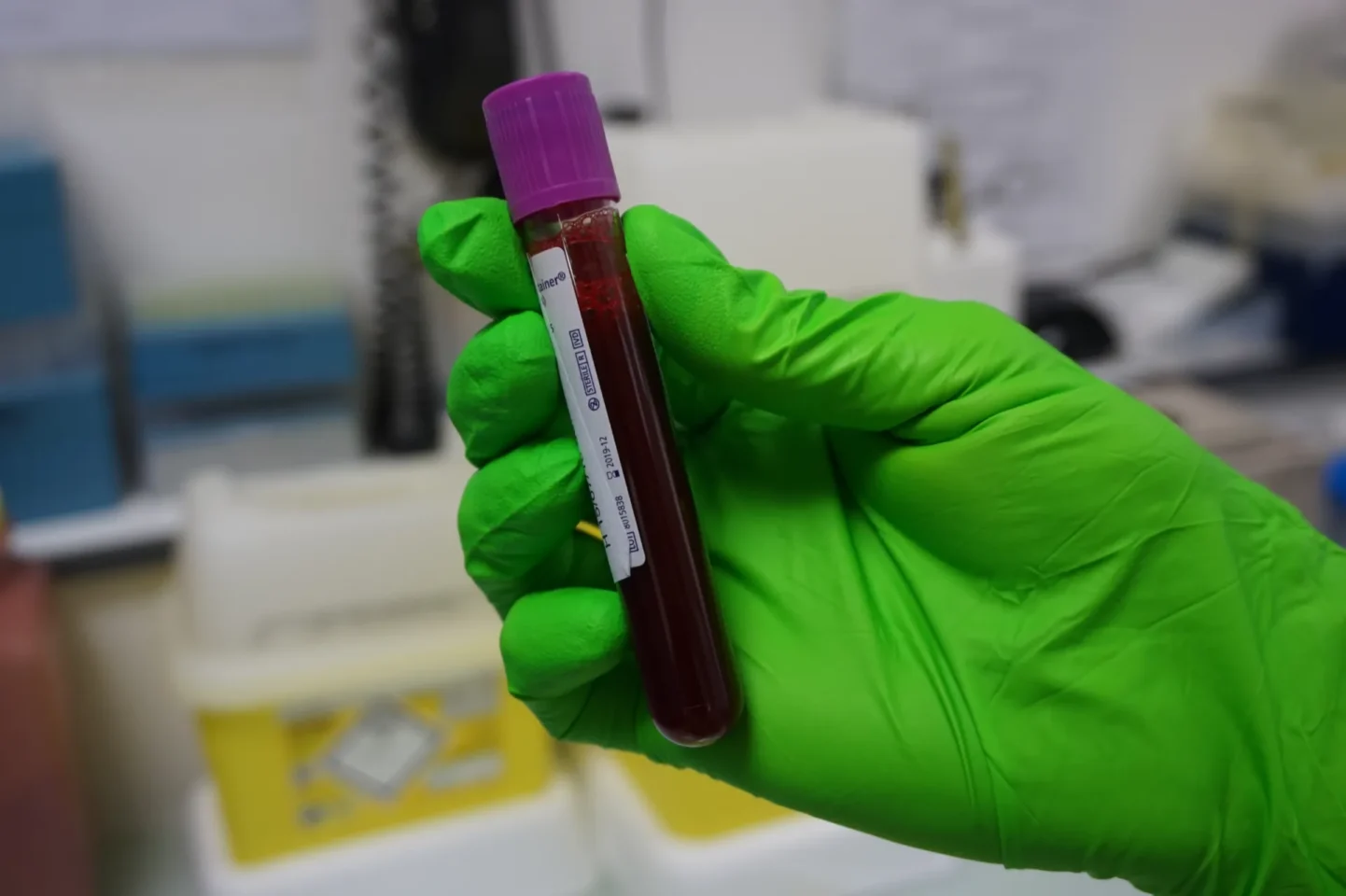 Professionnel de laboratoire préparant un échantillon sanguin pour une analyse moléculaire