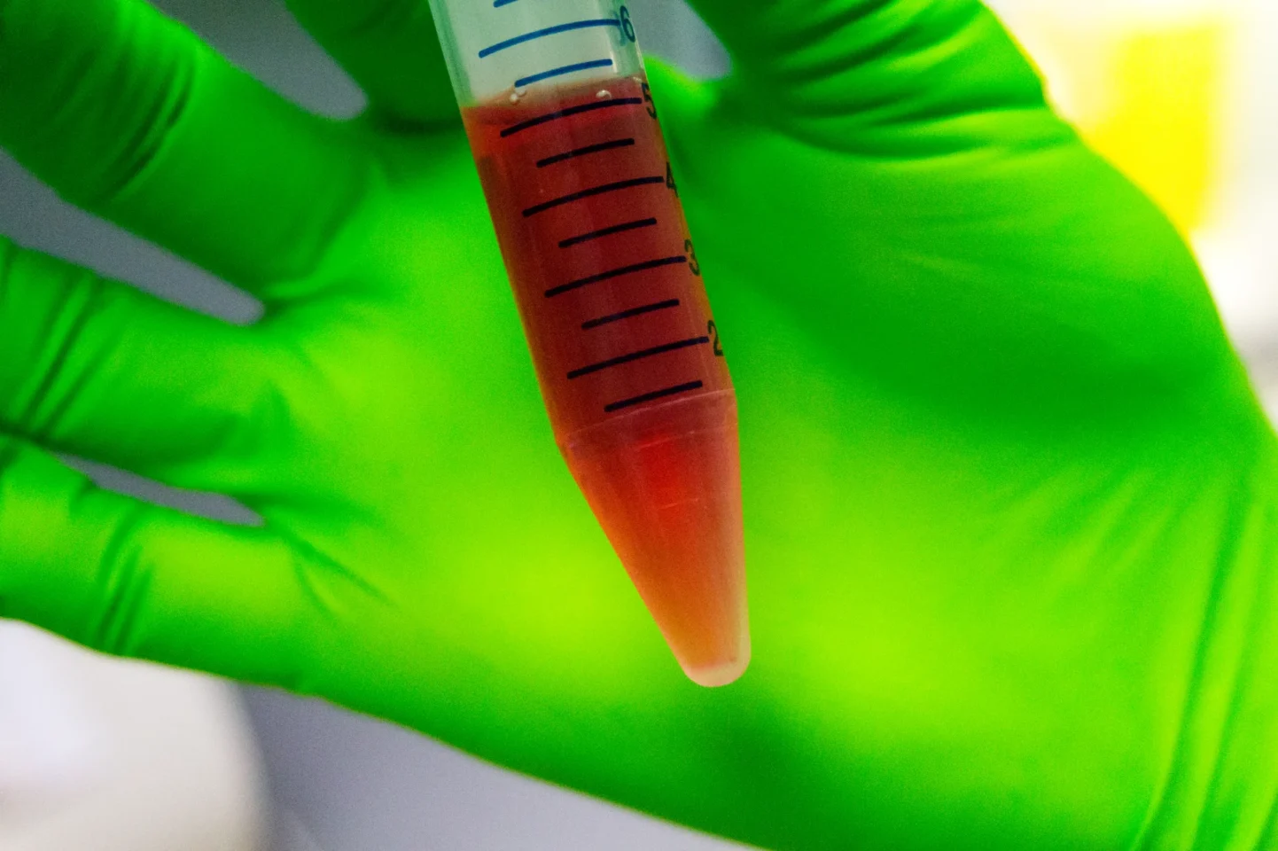 Professionnel de laboratoire tenant un échantillon de plasma.
