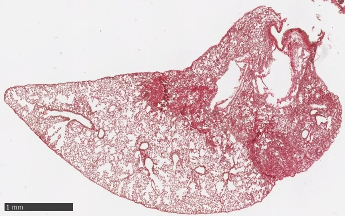 Le sFGFR3-Fc est un récepteur leurre soluble qui capte certains signaux favorisant la fibrose pulmonaire. Découvrez les résultats obtenus sur des cellules humaines et chez la souris.