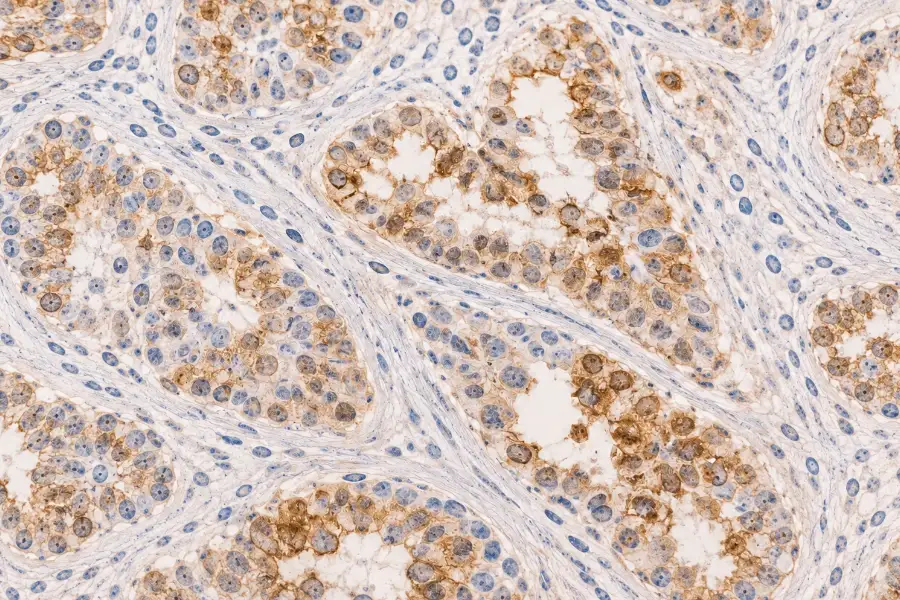 Illustration of a tumour tissue sample.