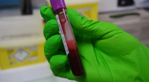Biopsie liquide