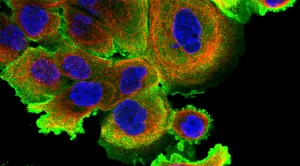 IA & Biomarqueurs
